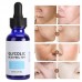 Melao Glycolic Acid Chemical Skin Peel 70% Strength 30ml